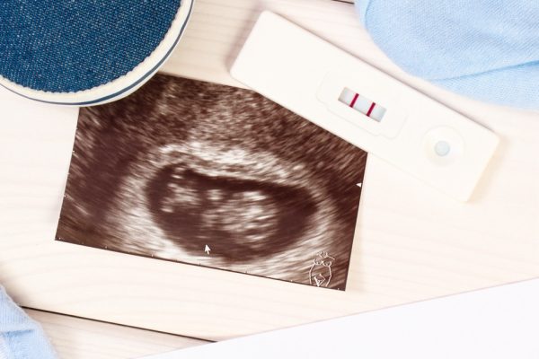 The Influence of Paternity Testing on Celebrities’ Legacies